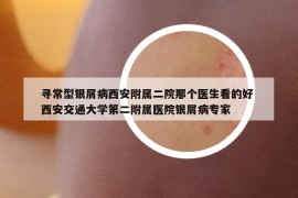 尋常型銀屑病西安附屬二院那個(gè)醫(yī)生看的好 西安交通大學(xué)第二附屬醫(yī)院銀屑病專家