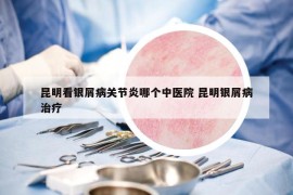 昆明看銀屑病關(guān)節(jié)炎哪個中醫(yī)院 昆明銀屑病治療
