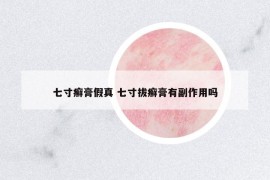 七寸癬膏假真 七寸拔癬膏有副作用嗎