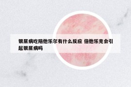 銀屑病吃陪他樂爾有什么反應(yīng) 倍他樂克會(huì)引起銀屑病嗎