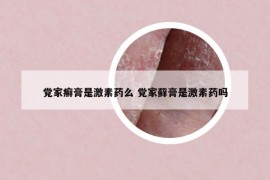 黨家癬膏是激素藥么 黨家蘚膏是激素藥嗎