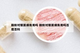 藕粉對銀屑病有用嗎 藕粉對銀屑病有用嗎百度百科