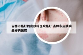 吉林市最好的皮膚科醫(yī)院最好 吉林市皮膚病最好的醫(yī)院