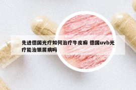 先進(jìn)德國(guó)光療如何治療牛皮癬 德國(guó)uvb光療能治銀屑病嗎
