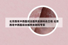 北京西苑中西醫(yī)結(jié)合醫(yī)院皮膚科白蘭地 北京西苑中西醫(yī)結(jié)合醫(yī)院皮膚科專家