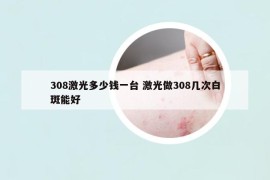 308激光多少錢一臺(tái) 激光做308幾次白斑能好