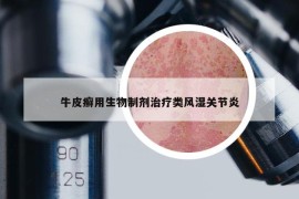 牛皮癬用生物制劑治療類風濕關節(jié)炎