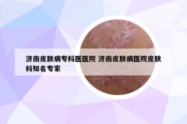 濟南皮膚病?？漆t(yī)醫(yī)院 濟南皮膚病醫(yī)院皮膚科知名專家