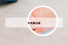 牛皮癬口袋