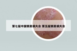 第七屆中國(guó)銀屑病大會(huì) 第五屆銀屑病大會(huì)
