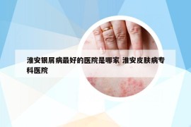 淮安銀屑病最好的醫(yī)院是哪家 淮安皮膚病?？漆t(yī)院