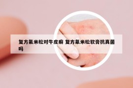 復(fù)方氟米松對(duì)牛皮癬 復(fù)方氟米松軟膏抗真菌嗎