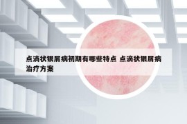 點(diǎn)滴狀銀屑病初期有哪些特點(diǎn) 點(diǎn)滴狀銀屑病治療方案