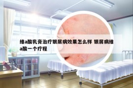 維a酸乳膏治療銀屑病效果怎么樣 銀屑病維a酸一個療程