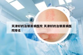 天津好的治銀屑病醫(yī)院 天津好的治銀屑病醫(yī)院排名