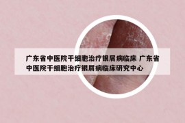 廣東省中醫(yī)院干細(xì)胞治療銀屑病臨床 廣東省中醫(yī)院干細(xì)胞治療銀屑病臨床研究中心