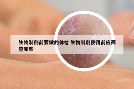 生物制劑前要做的體檢 生物制劑使用前應(yīng)篩查哪些