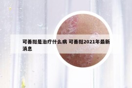 可善挺是治療什么病 可善挺2021年最新消息
