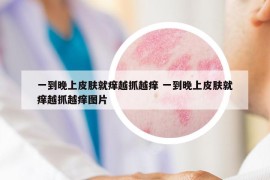 一到晚上皮膚就癢越抓越癢 一到晚上皮膚就癢越抓越癢圖片