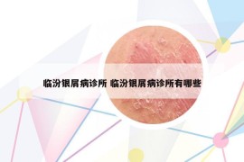 臨汾銀屑病診所 臨汾銀屑病診所有哪些