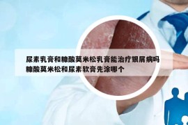 尿素乳膏和糠酸莫米松乳膏能治療銀屑病嗎 糠酸莫米松和尿素軟膏先涂哪個