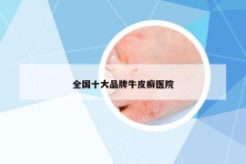 全國(guó)十大品牌牛皮癬醫(yī)院