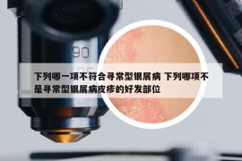 下列哪一項(xiàng)不符合尋常型銀屑病 下列哪項(xiàng)不是尋常型銀屑病皮疹的好發(fā)部位
