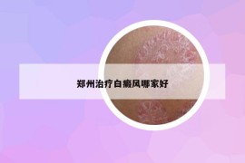 鄭州治療白癜風哪家好