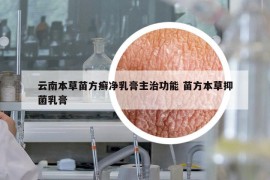 云南本草苗方癬凈乳膏主治功能 苗方本草抑菌乳膏