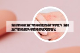 洛陽銀屑病治療銀屑病醫(yī)院最好的地方 洛陽治療銀屑病鄭州銀屑病研究院地址