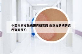 中國南京皮膚病研究所官網(wǎng) 南京皮膚病研究所官網(wǎng)預(yù)約