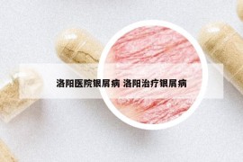 洛陽醫(yī)院銀屑病 洛陽治療銀屑病