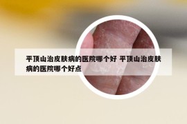 平頂山治皮膚病的醫(yī)院哪個好 平頂山治皮膚病的醫(yī)院哪個好點(diǎn)