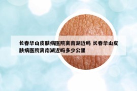 長(zhǎng)春華山皮膚病醫(yī)院離南湖近嗎 長(zhǎng)春華山皮膚病醫(yī)院離南湖近嗎多少公里