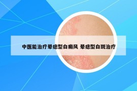 中醫(yī)能治療暈痣型白癜風(fēng) 暈痣型白斑治療