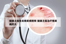 健康之路有關(guān)銀屑病視頻 健康之路治療銀屑病藥方