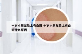 十歲小朋友臉上有白斑 十歲小朋友臉上有白斑什么原因
