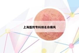 上海醫(yī)院專科排名白癜風(fēng)