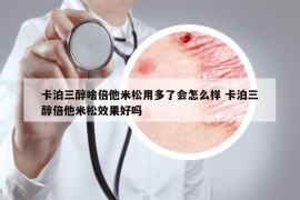 卡泊三醇啥倍他米松用多了會怎么樣 卡泊三醇倍他米松效果好嗎