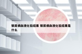 銀屑病血液化驗結(jié)果 銀屑病血液化驗結(jié)果是什么