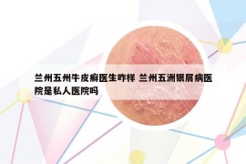 蘭州五州牛皮癬醫(yī)生咋樣 蘭州五洲銀屑病醫(yī)院是私人醫(yī)院嗎