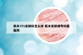 新鄉(xiāng)371皮膚科怎么樣 新鄉(xiāng)皮膚病?？漆t(yī)醫(yī)院