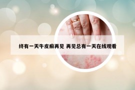 終有一天牛皮癬再見 再見總有一天在線觀看