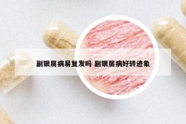 副銀屑病易復發(fā)嗎 副銀屑病好轉跡象