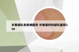 長(zhǎng)春部隊(duì)皮膚病醫(yī)院 長(zhǎng)春最好的部隊(duì)醫(yī)院208