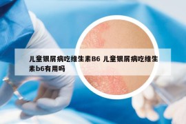 兒童銀屑病吃維生素B6 兒童銀屑病吃維生素b6有用嗎