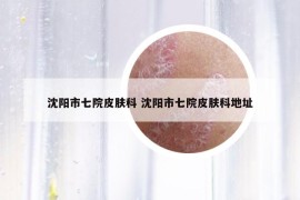 沈陽市七院皮膚科 沈陽市七院皮膚科地址