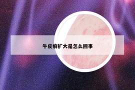 牛皮癬擴(kuò)大是怎么回事