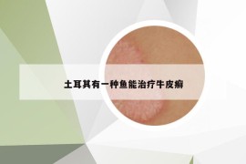 土耳其有一種魚能治療牛皮癬