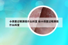 小孩查過敏源掛什么科室 給小孩查過敏源掛什么科室